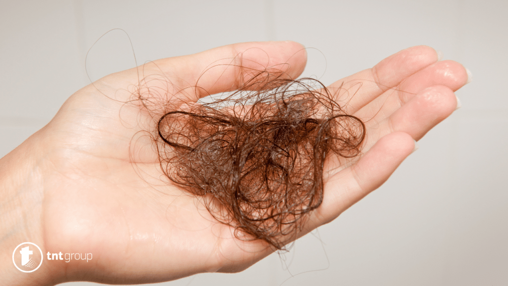 Kako spriječiti gubitak kose prirodnim tretmanima